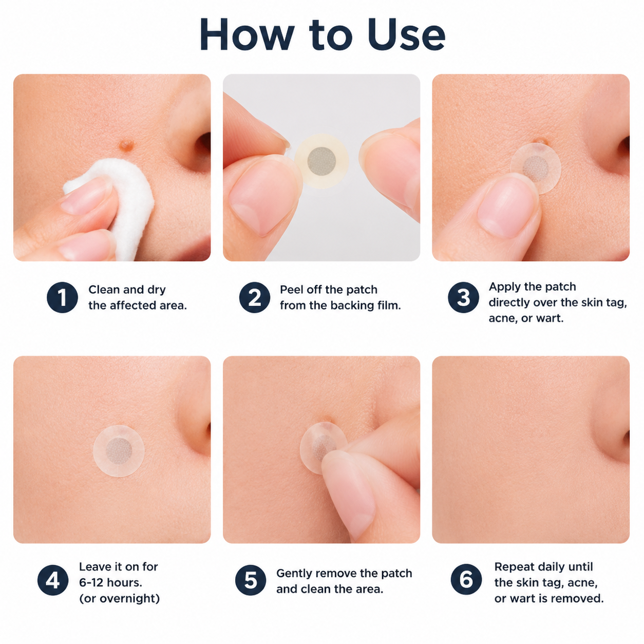 ✨Nuvopaw®2-in-1 Microneedle & Hydrocolloid Patch🍀| Removes Raised Moles, Acne, Flat Warts & Skin Tags | Helps Improve Wrinkles, Scars & Blemishes | Invisible Patches for Face & Body