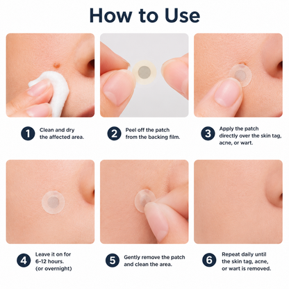 ✨Nuvopaw®2-in-1 Microneedle & Hydrocolloid Patch🍀| Removes Raised Moles, Acne, Flat Warts & Skin Tags | Helps Improve Wrinkles, Scars & Blemishes | Invisible Patches for Face & Body